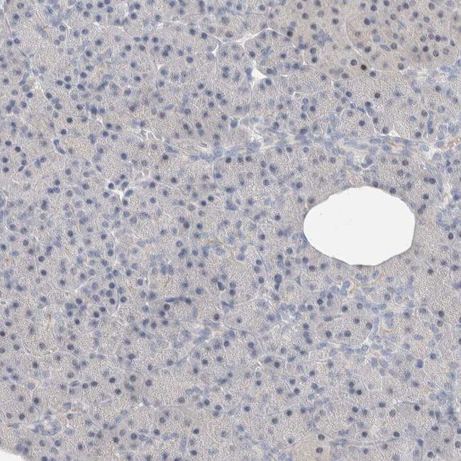 DNAJB6 Antibody in Immunohistochemistry (IHC)