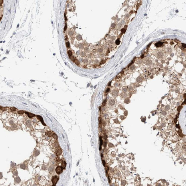 DNAJB6 Antibody in Immunohistochemistry (IHC)