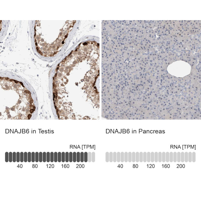 DNAJB6 Antibody