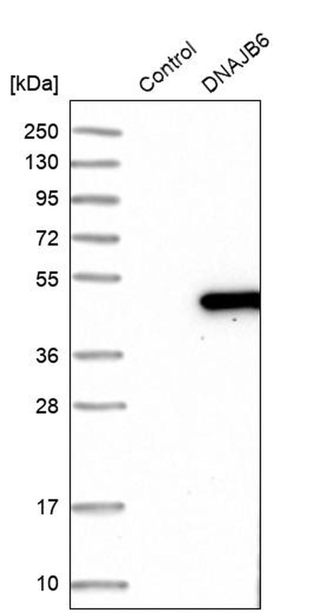 DNAJB6 Antibody in Western Blot (WB)