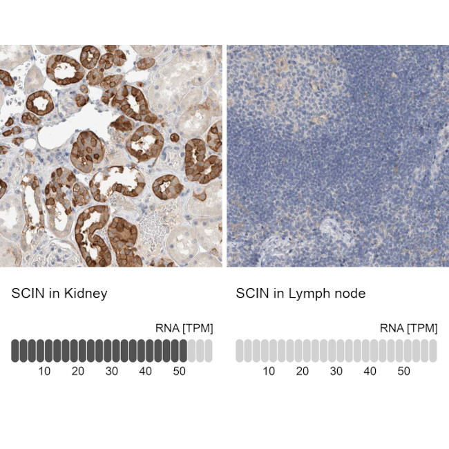 SCIN Antibody in Immunohistochemistry (IHC)