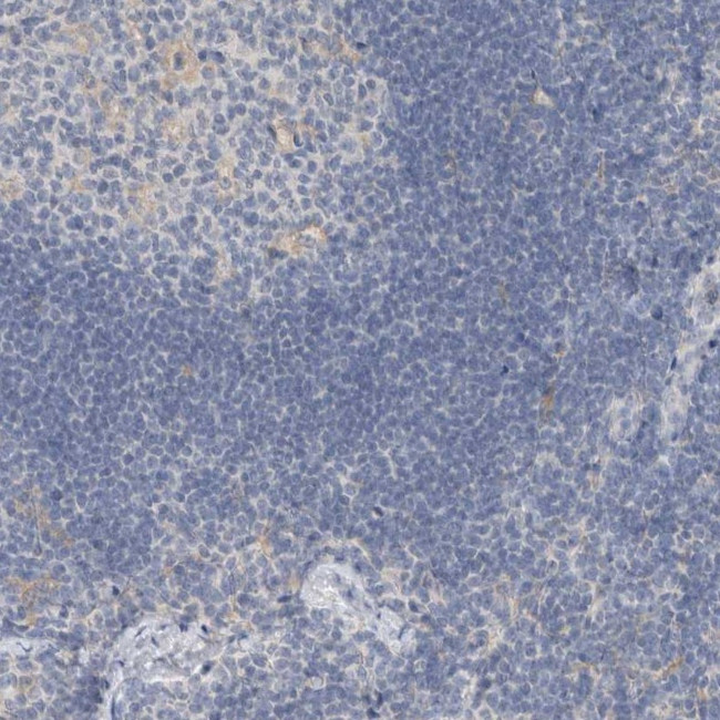 SCIN Antibody in Immunohistochemistry (IHC)