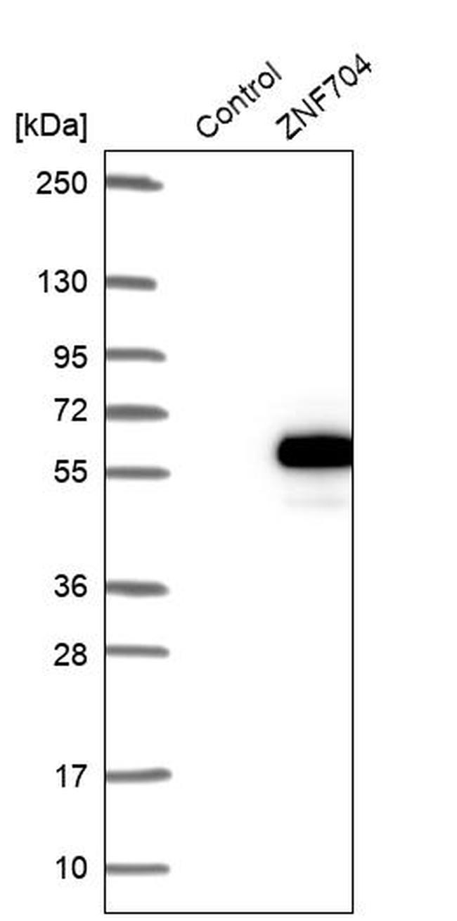 ZNF704 Antibody in Western Blot (WB)