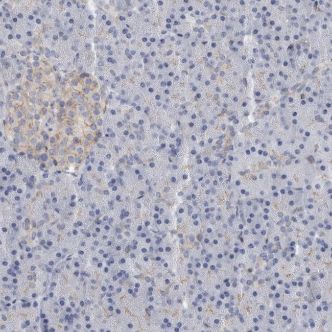 B3GNT3 Antibody in Immunohistochemistry (IHC)