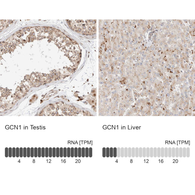 GCN1L1 Antibody in Immunohistochemistry (IHC)
