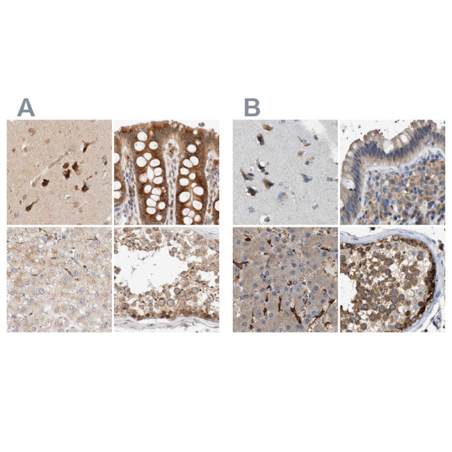 GCN1L1 Antibody in Immunohistochemistry (IHC)