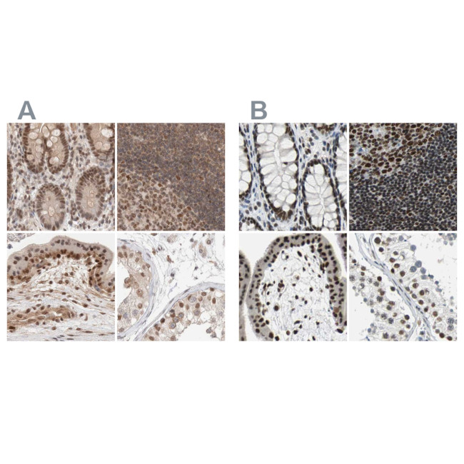 GATAD2A Antibody in Immunohistochemistry (IHC)