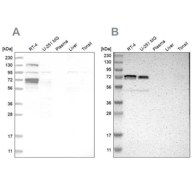 GATAD2A Antibody in Western Blot (WB)