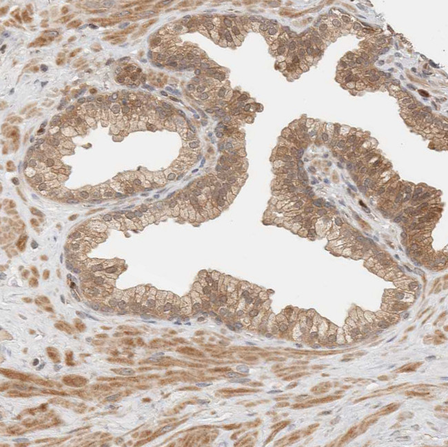 ADSS Antibody in Immunohistochemistry (IHC)