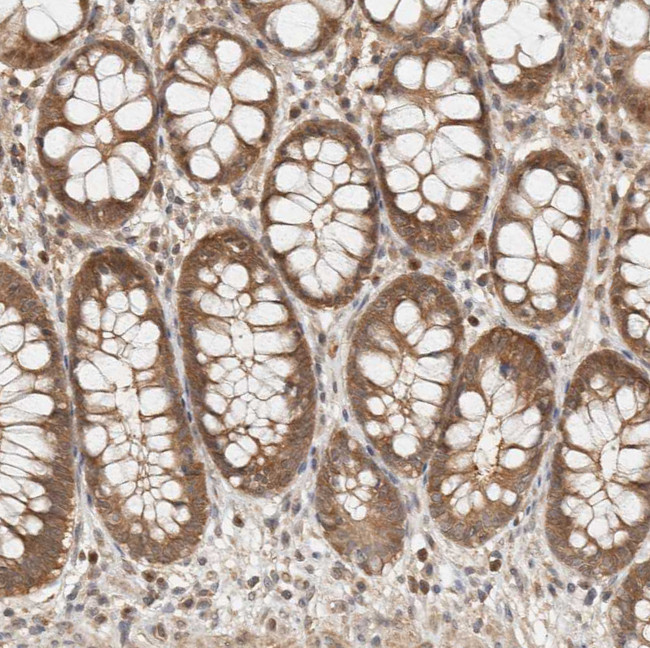 ADSS Antibody in Immunohistochemistry (IHC)