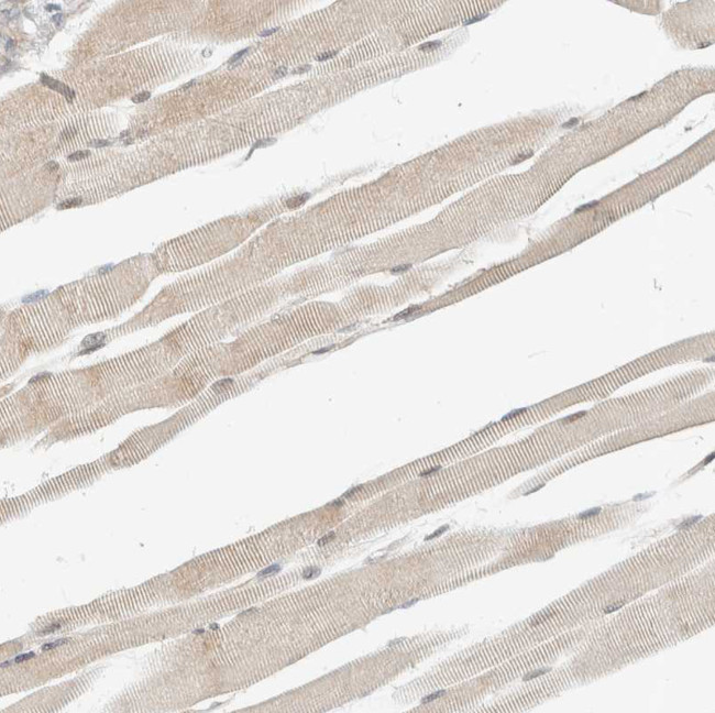 ADSS Antibody in Immunohistochemistry (IHC)