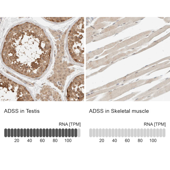 ADSS Antibody