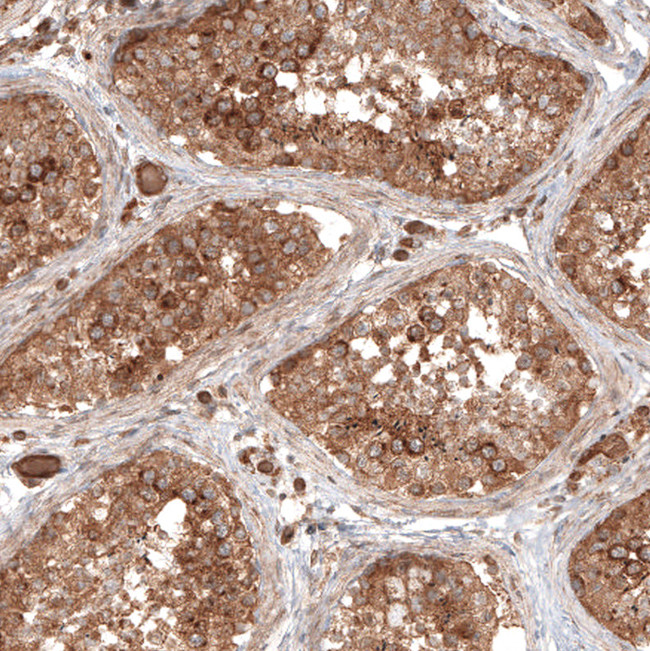 TAX1BP1 Antibody in Immunohistochemistry (IHC)