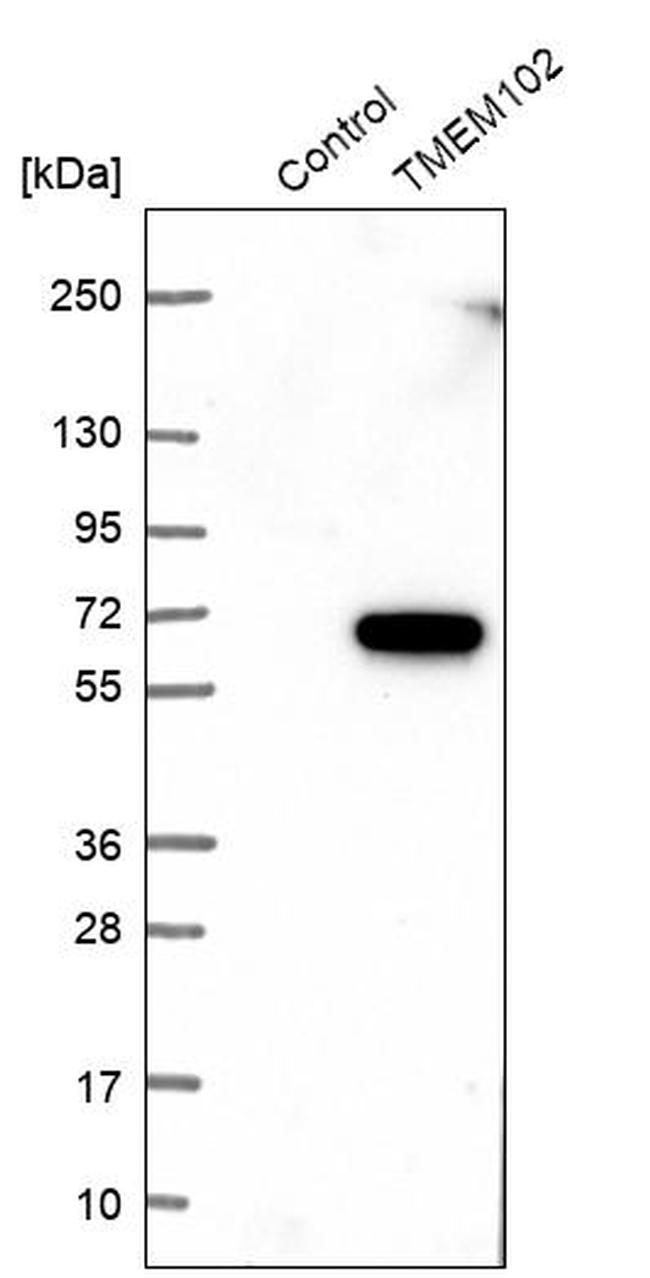 TMEM102 Antibody in Western Blot (WB)