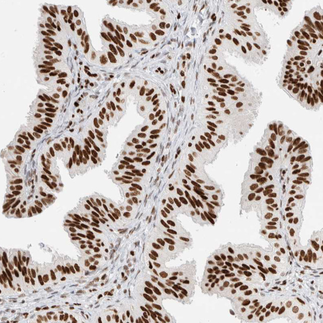 C17orf49 Antibody in Immunohistochemistry (IHC)