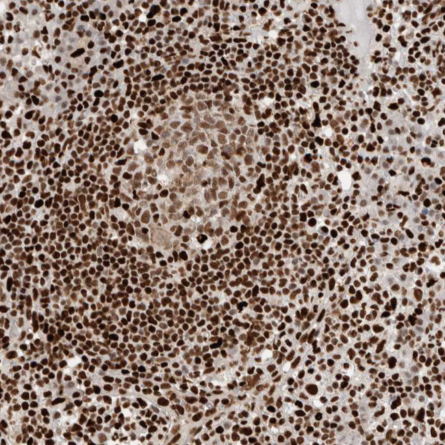 C17orf49 Antibody in Immunohistochemistry (IHC)