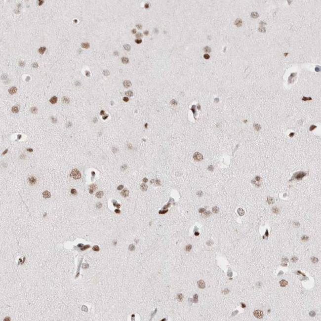 C17orf49 Antibody in Immunohistochemistry (IHC)