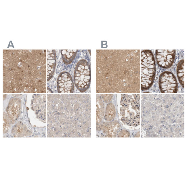 WIPF2 Antibody in Immunohistochemistry (IHC)