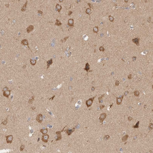 WIPF2 Antibody in Immunohistochemistry (IHC)