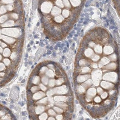 WIPF2 Antibody in Immunohistochemistry (IHC)