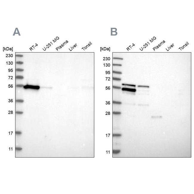 WIPF2 Antibody in Western Blot (WB)