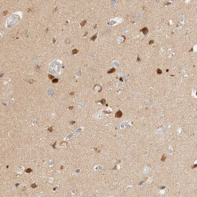 SGSM2 Antibody in Immunohistochemistry (IHC)