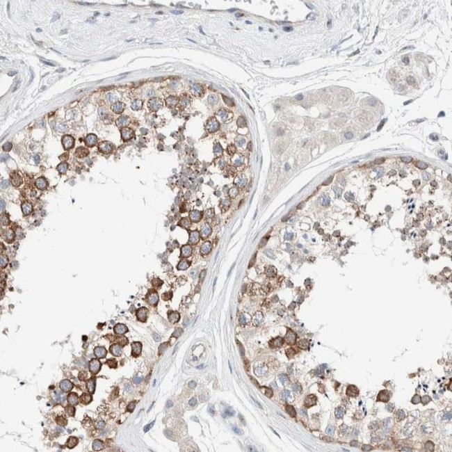 CASC3 Antibody in Immunohistochemistry (IHC)