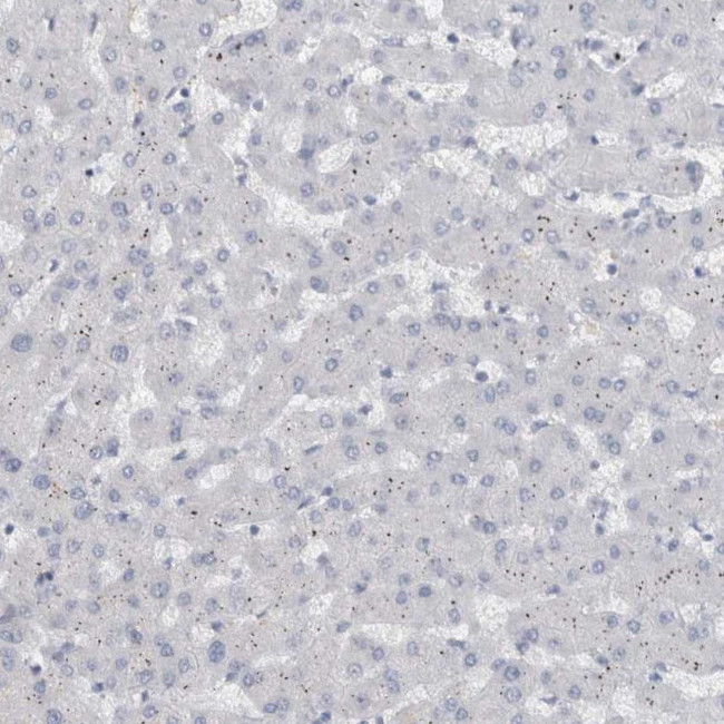 ADAM2 Antibody in Immunohistochemistry (IHC)