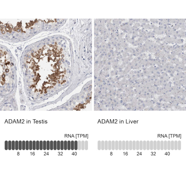 ADAM2 Antibody