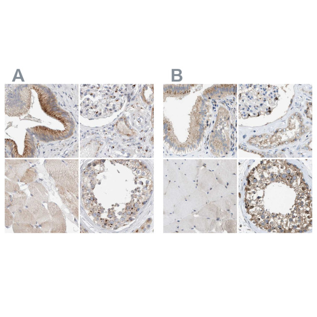 SLC38A10 Antibody in Immunohistochemistry (IHC)