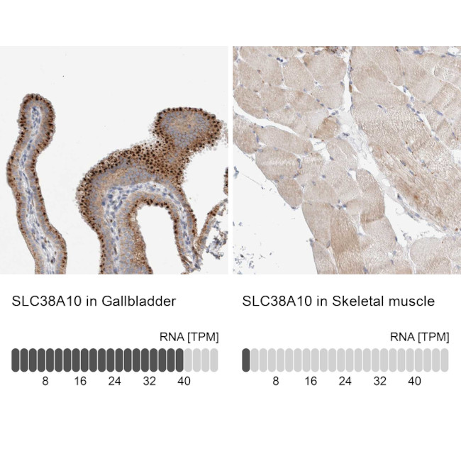 SLC38A10 Antibody