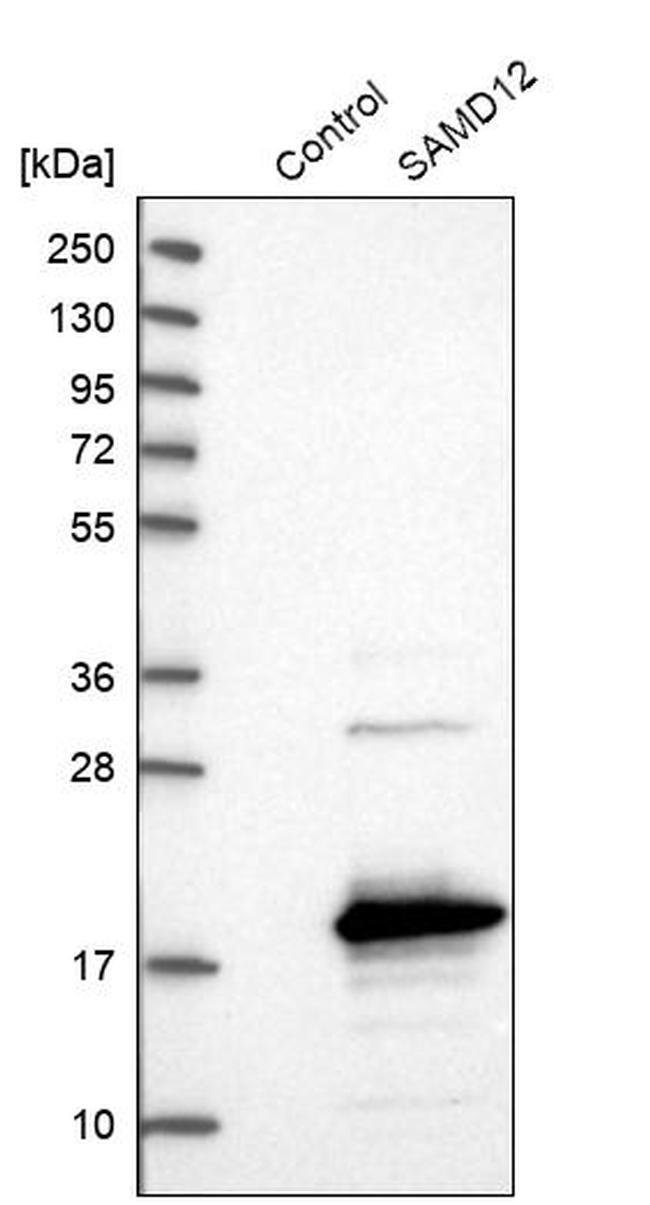 SAMD12 Antibody in Western Blot (WB)