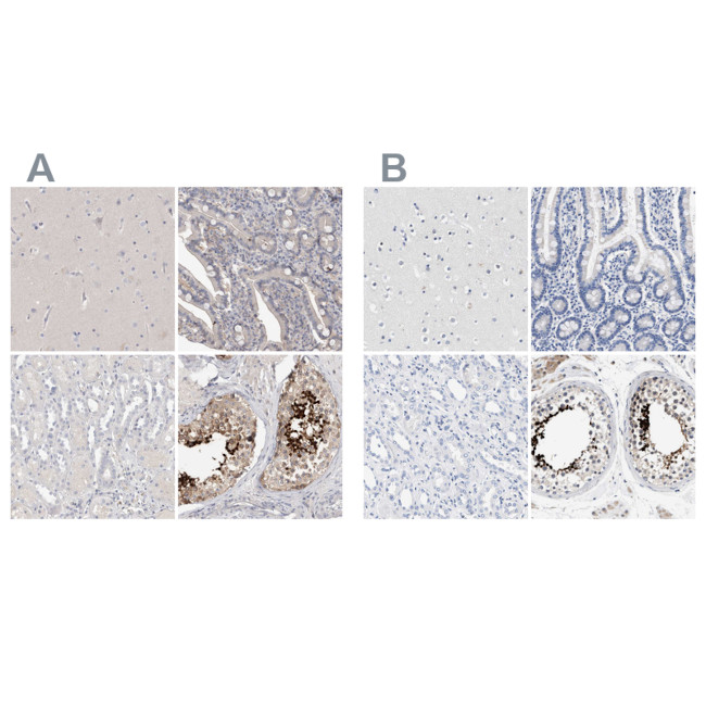 Actin-like 7B Antibody in Immunohistochemistry (IHC)