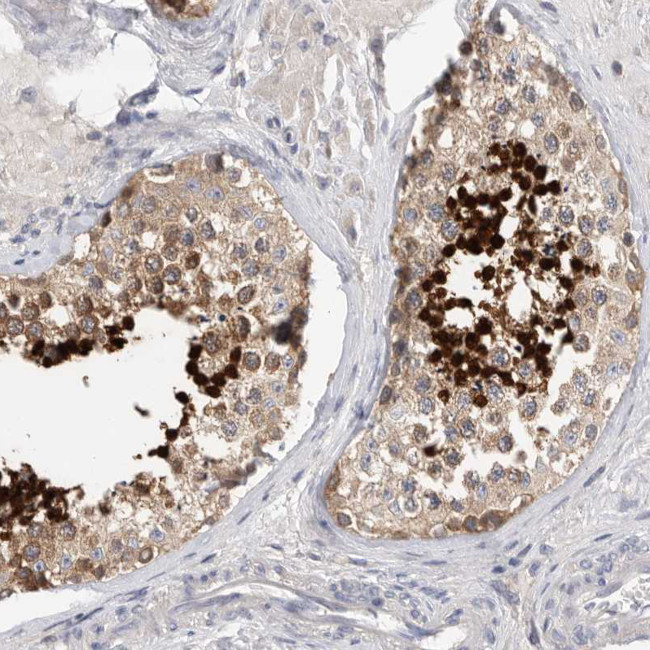 Actin-like 7B Antibody in Immunohistochemistry (IHC)