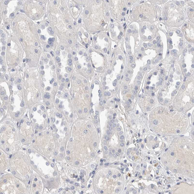 Actin-like 7B Antibody in Immunohistochemistry (IHC)