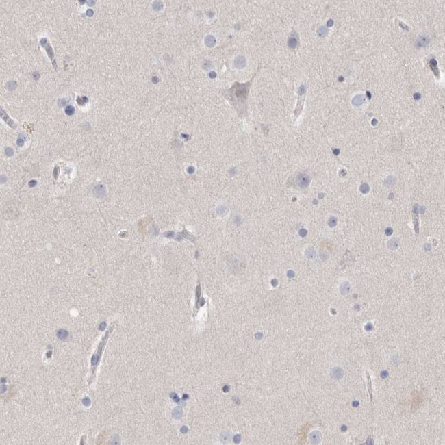 Actin-like 7B Antibody in Immunohistochemistry (IHC)