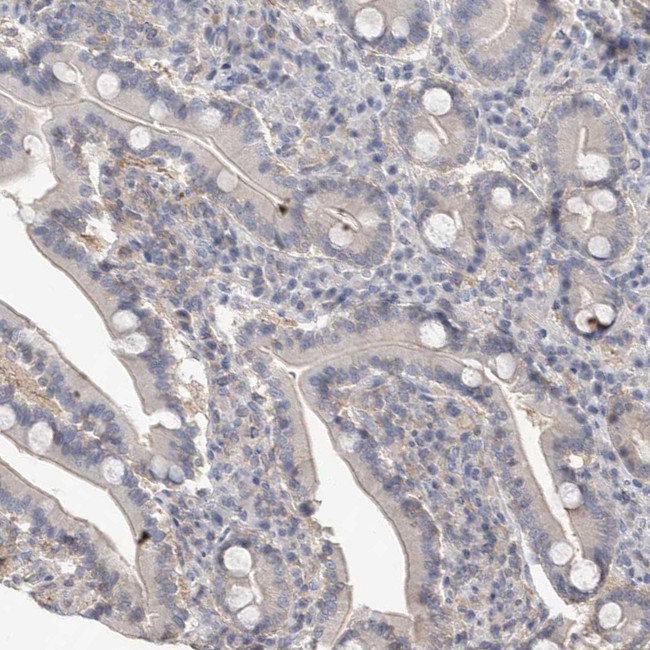 Actin-like 7B Antibody in Immunohistochemistry (IHC)