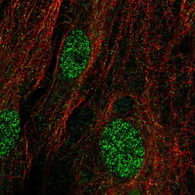 KIAA1456 Antibody in Immunocytochemistry (ICC/IF)