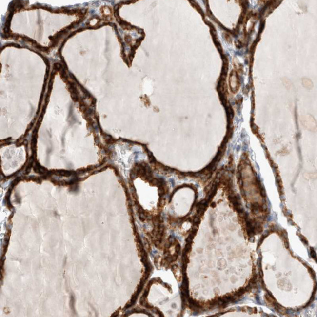 KIAA1456 Antibody in Immunohistochemistry (IHC)