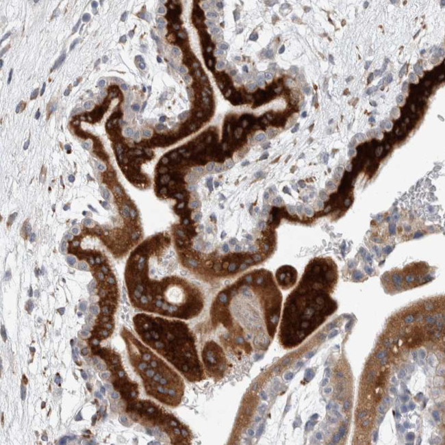 KIAA1456 Antibody in Immunohistochemistry (IHC)