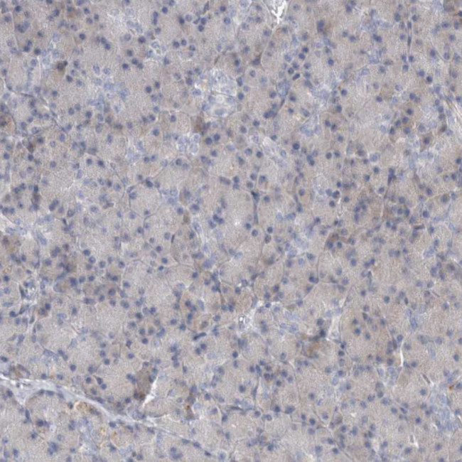 KIAA1456 Antibody in Immunohistochemistry (IHC)