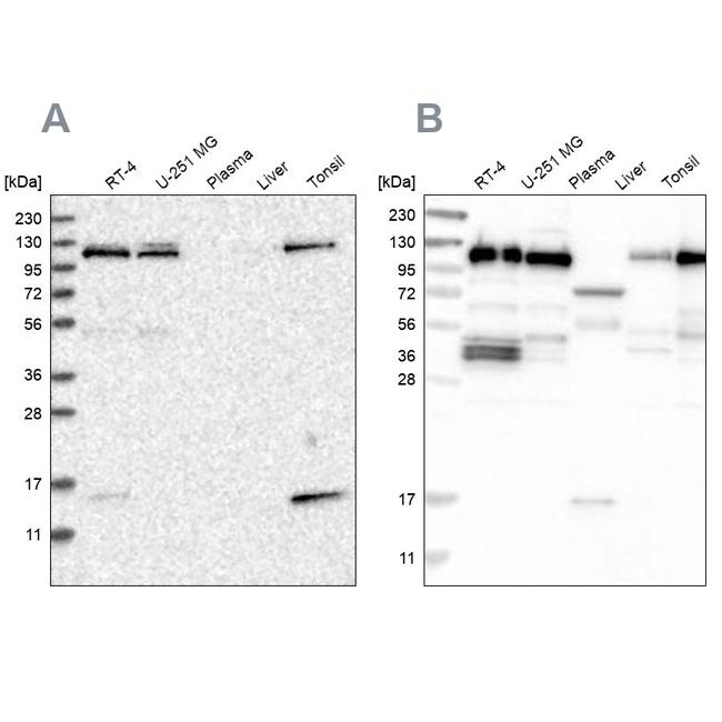 RABEP1 Antibody in Western Blot (WB)