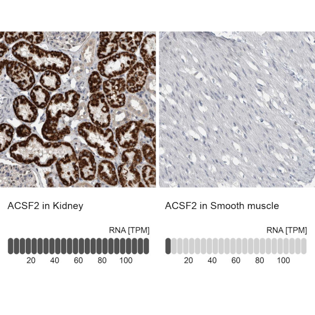 ACSF2 Antibody in Immunohistochemistry (IHC)