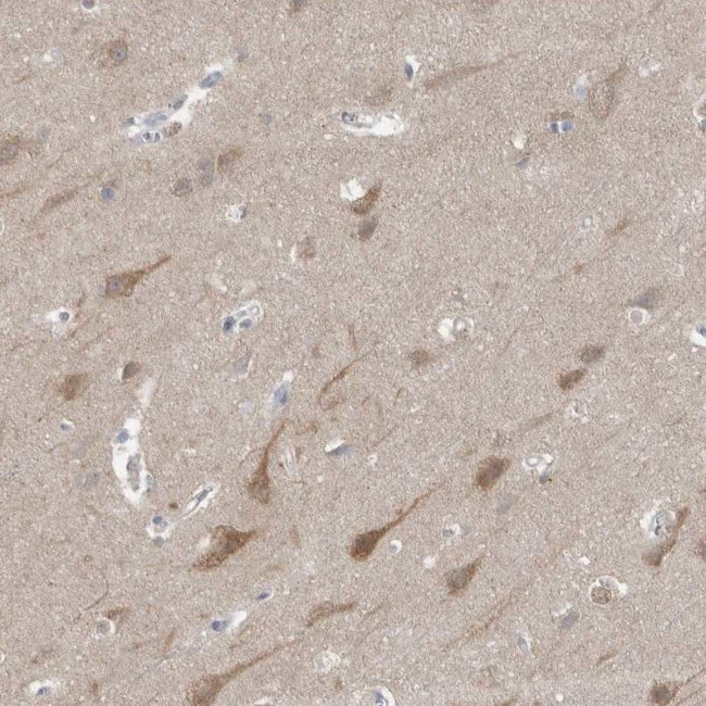 Gephyrin Antibody in Immunohistochemistry (IHC)