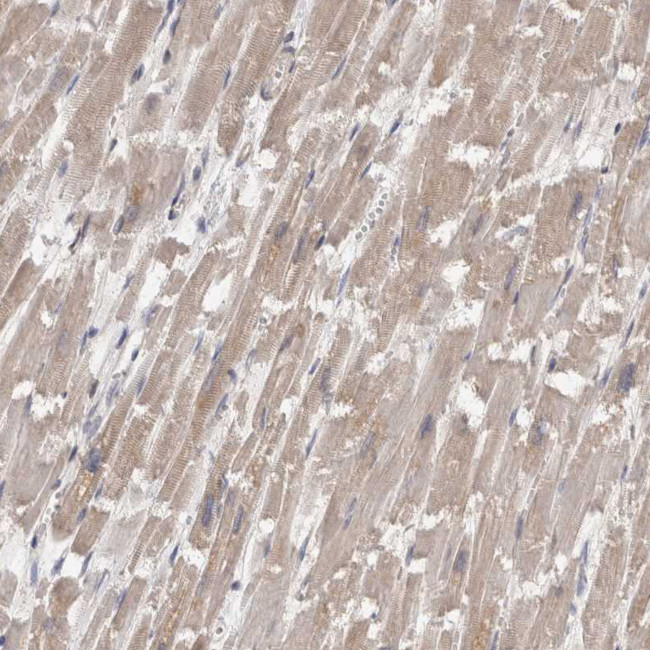 FHOD3 Antibody in Immunohistochemistry (IHC)