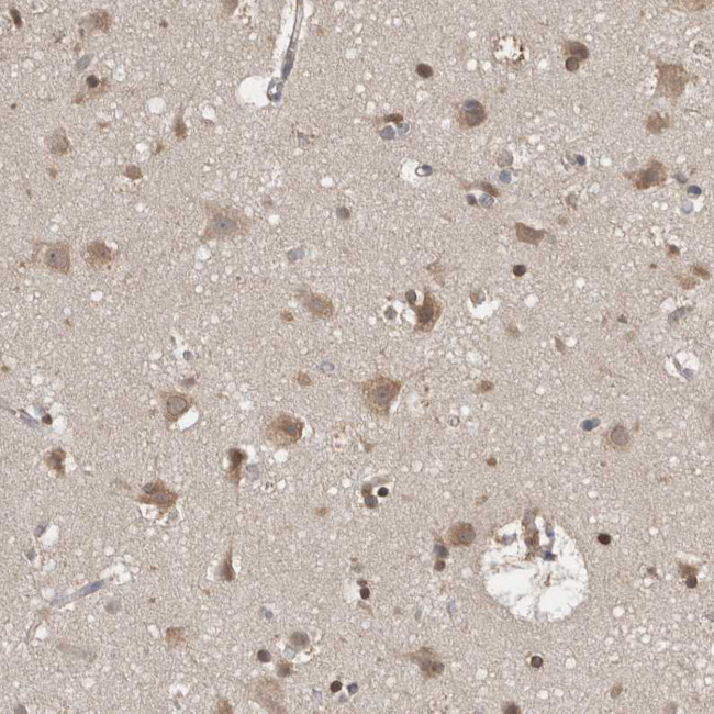 FHOD3 Antibody in Immunohistochemistry (IHC)