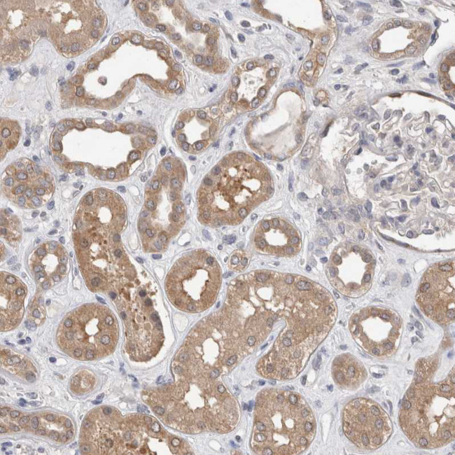 FHOD3 Antibody in Immunohistochemistry (IHC)