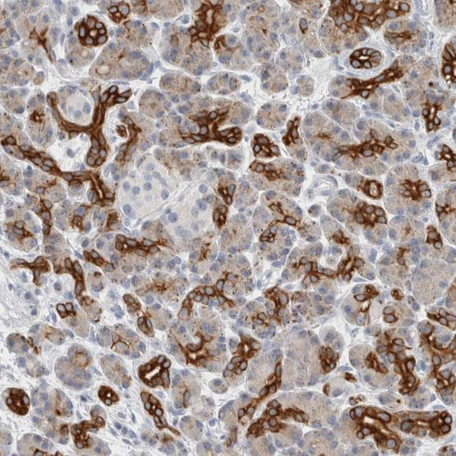 SLC28A3 Antibody in Immunohistochemistry (IHC)