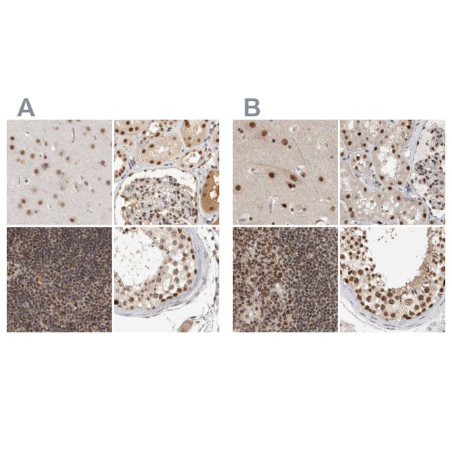 ZNF830 Antibody in Immunohistochemistry (IHC)