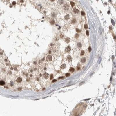 ZNF830 Antibody in Immunohistochemistry (IHC)